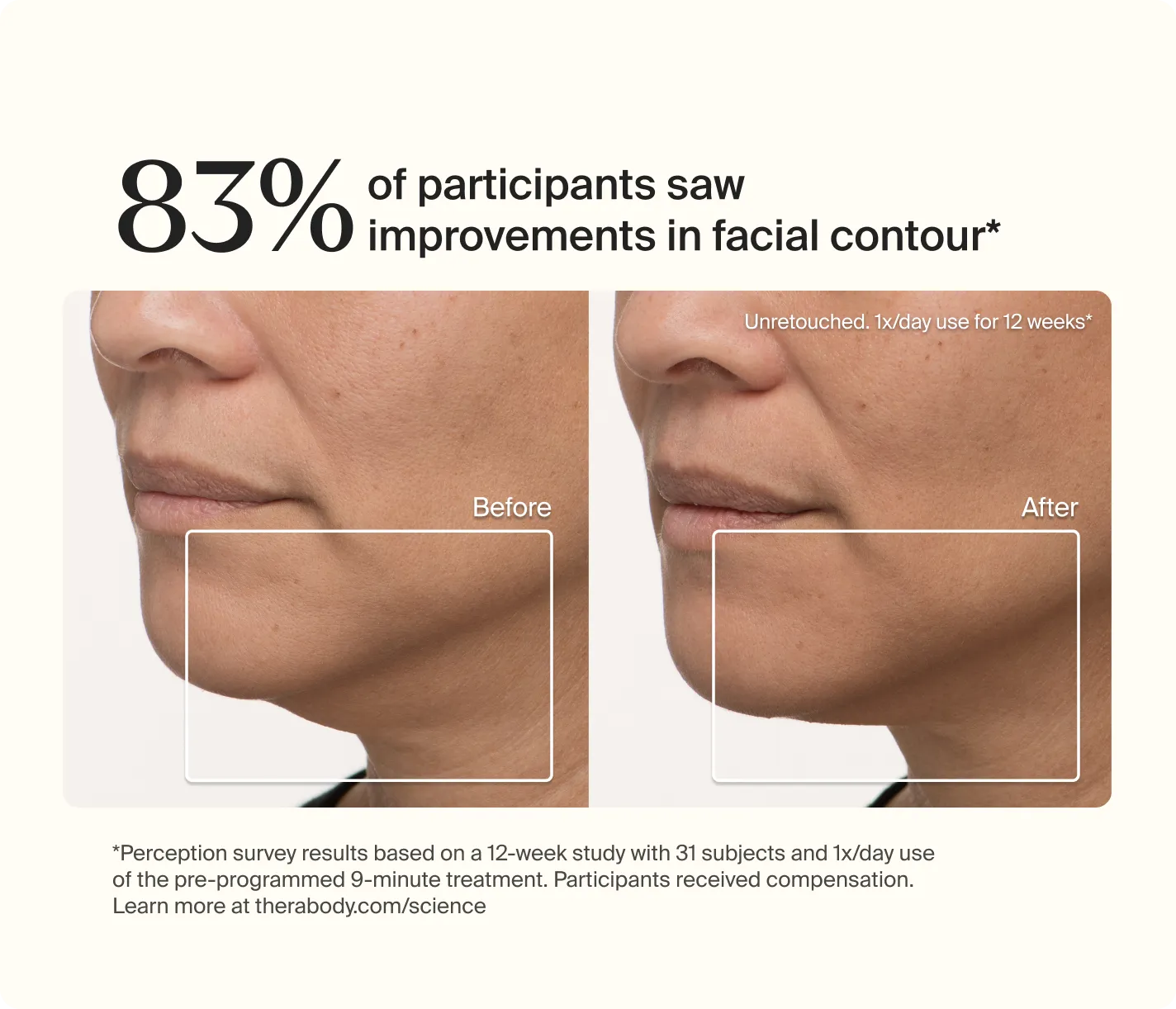 83% of participants saw improvements in facial contour* | Un-retouched. 1x/day use for 12 weeks* | Before | After |  *Perception survey results based on a 12-week study with 31 subjects and 1x/day use of the pre-programmed 9-minute treatment. Participants received compensation. Learn more at therabody.com/science